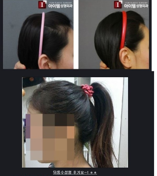 Illustration for article titled "Round Head" Plastic Surgery Seems Excessive, Even for South Korea